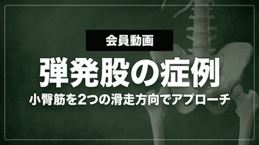 股関節痛・弾発股の症例：小臀筋への2つの滑走アプローチ