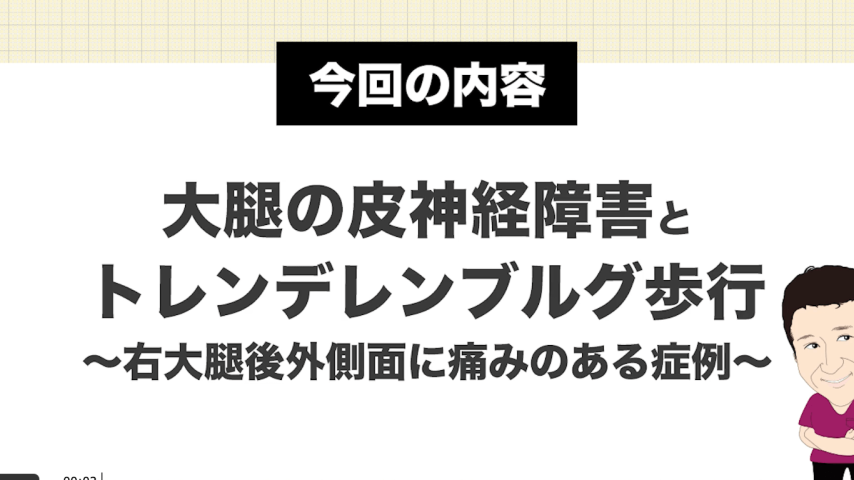 大腿の皮神経障害とトレンデレンブルグ歩行【会員限定動画】